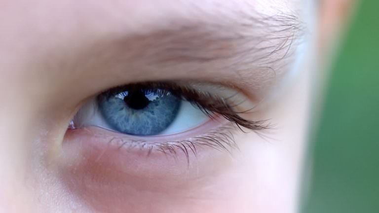 ¿Qué es la Iridología?