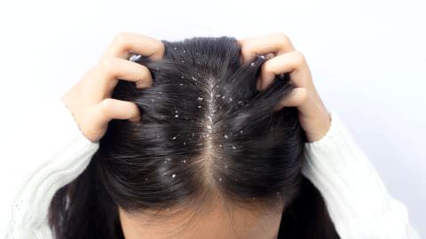 Cubre Caspa a México