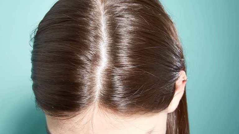Un medicamento para el crecimiento del cabello