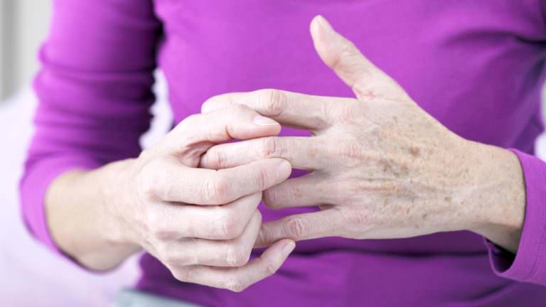 La realidad de la artritis reumatoide