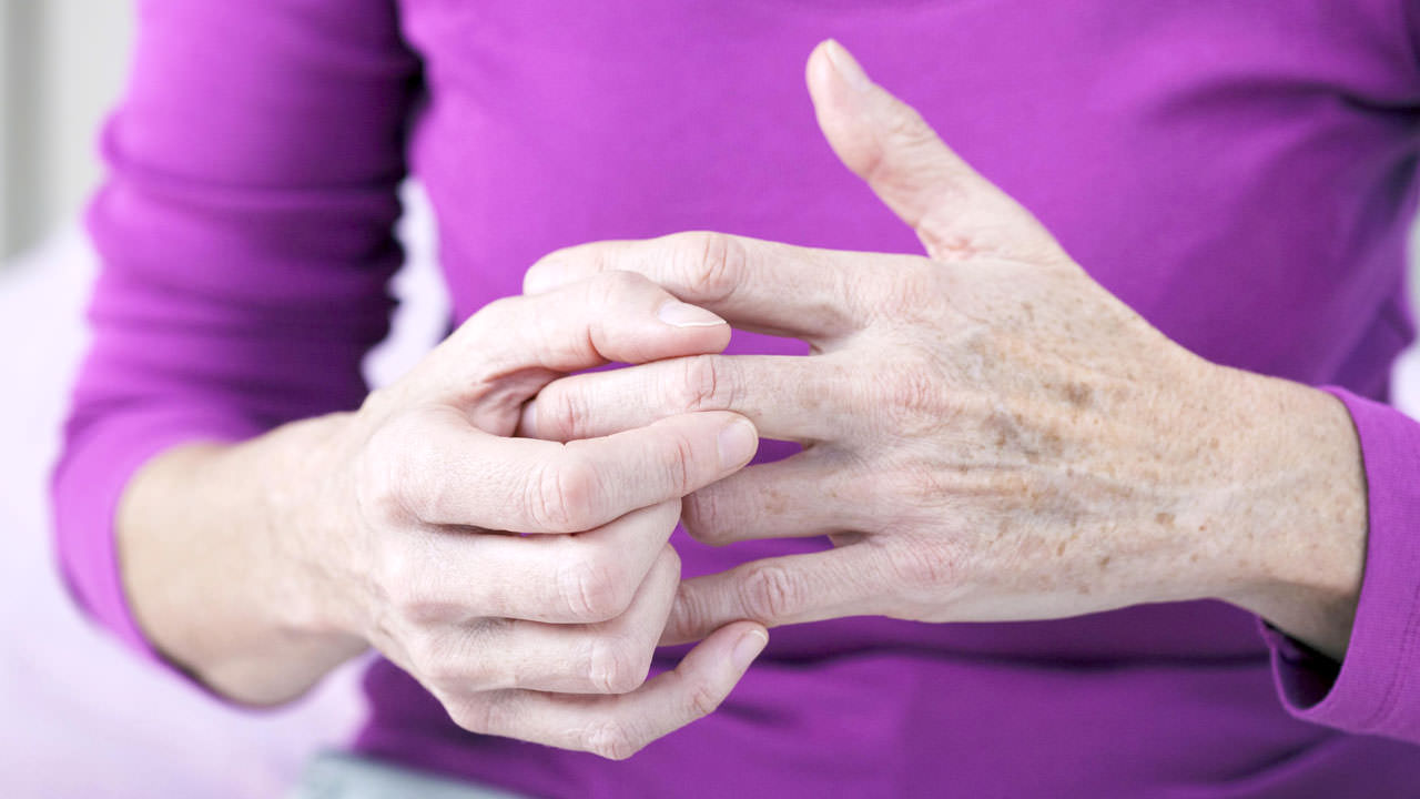 La realidad de la artritis reumatoide